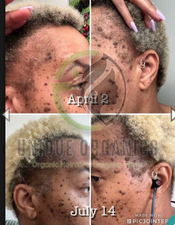 Moisturizing Alopecia Hair Cream With Clove, Fenugreek, Ginger and Moringa