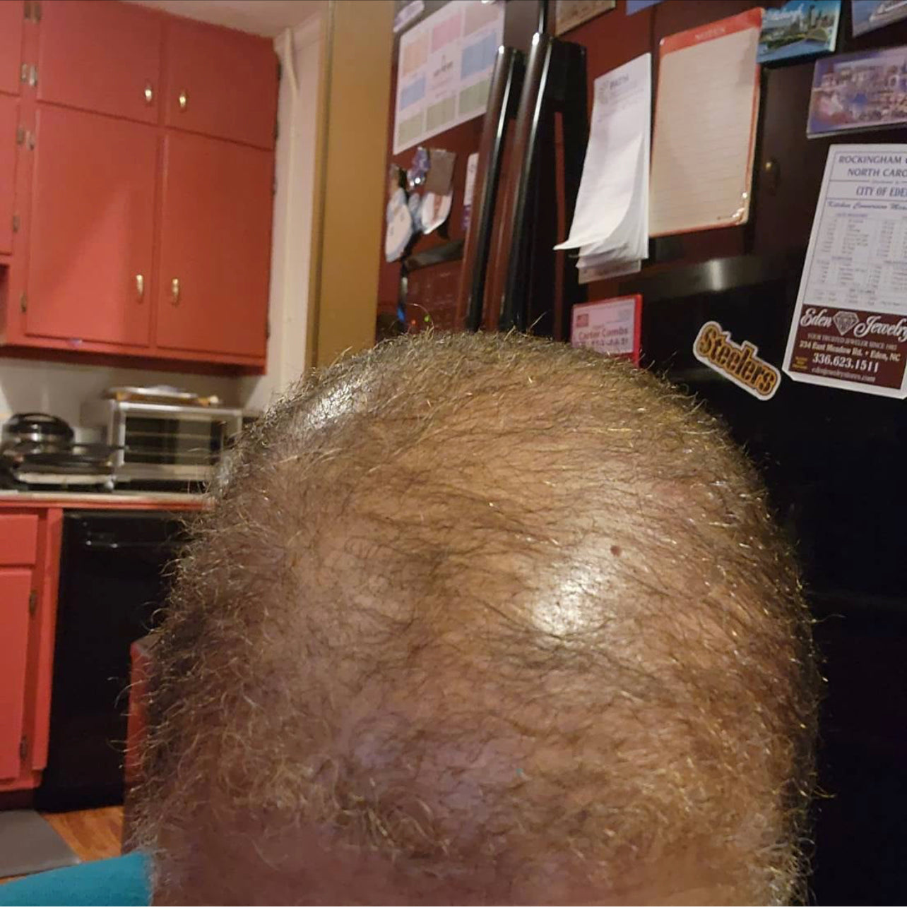 Ayurvedic Alopecia Hair Oil