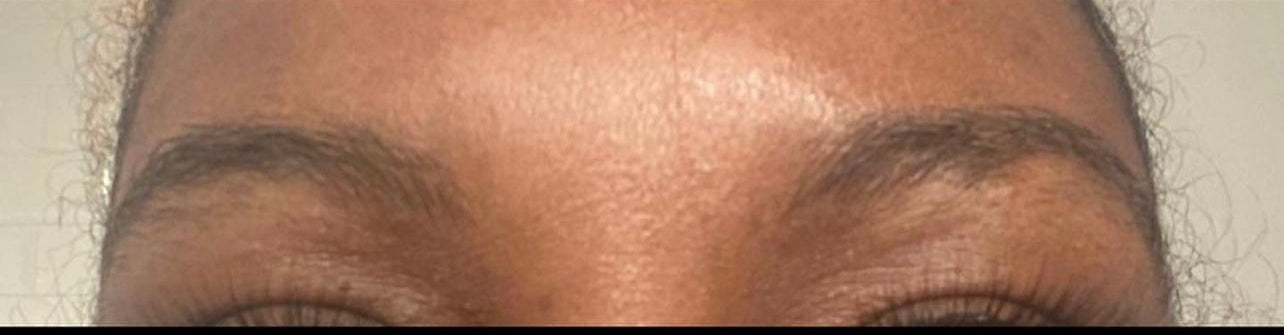 Eyelash and Eyebrow Serum