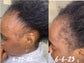 40 Ingredients Alopecia Hair Oil