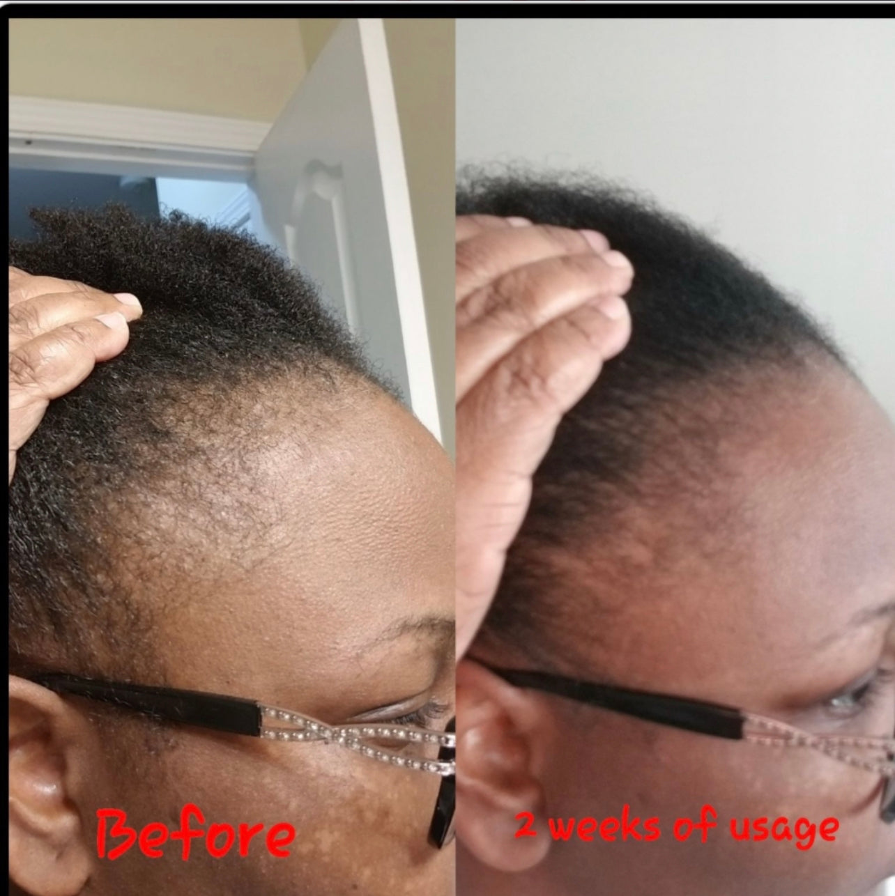 I Want My Edges Back Temple Cream / Organic Edge Growth Cream 2 oz.