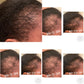 Organic 40 Ingredients Alopecia Hair Oil