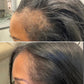 Organic Alopecia Hair Oil